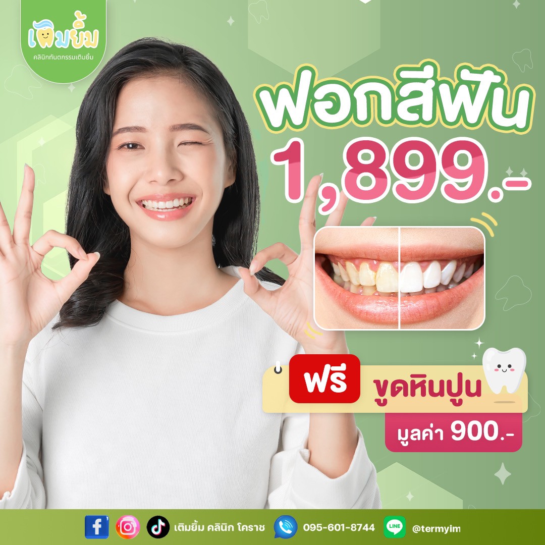 ฟอกสีฟัน Cool Light