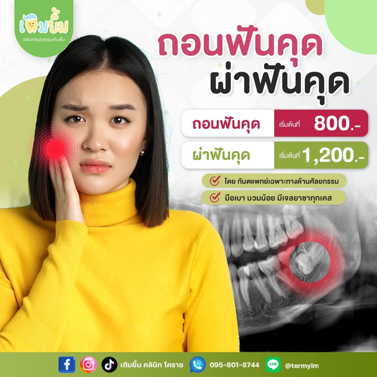 ผ่าฟันคุด