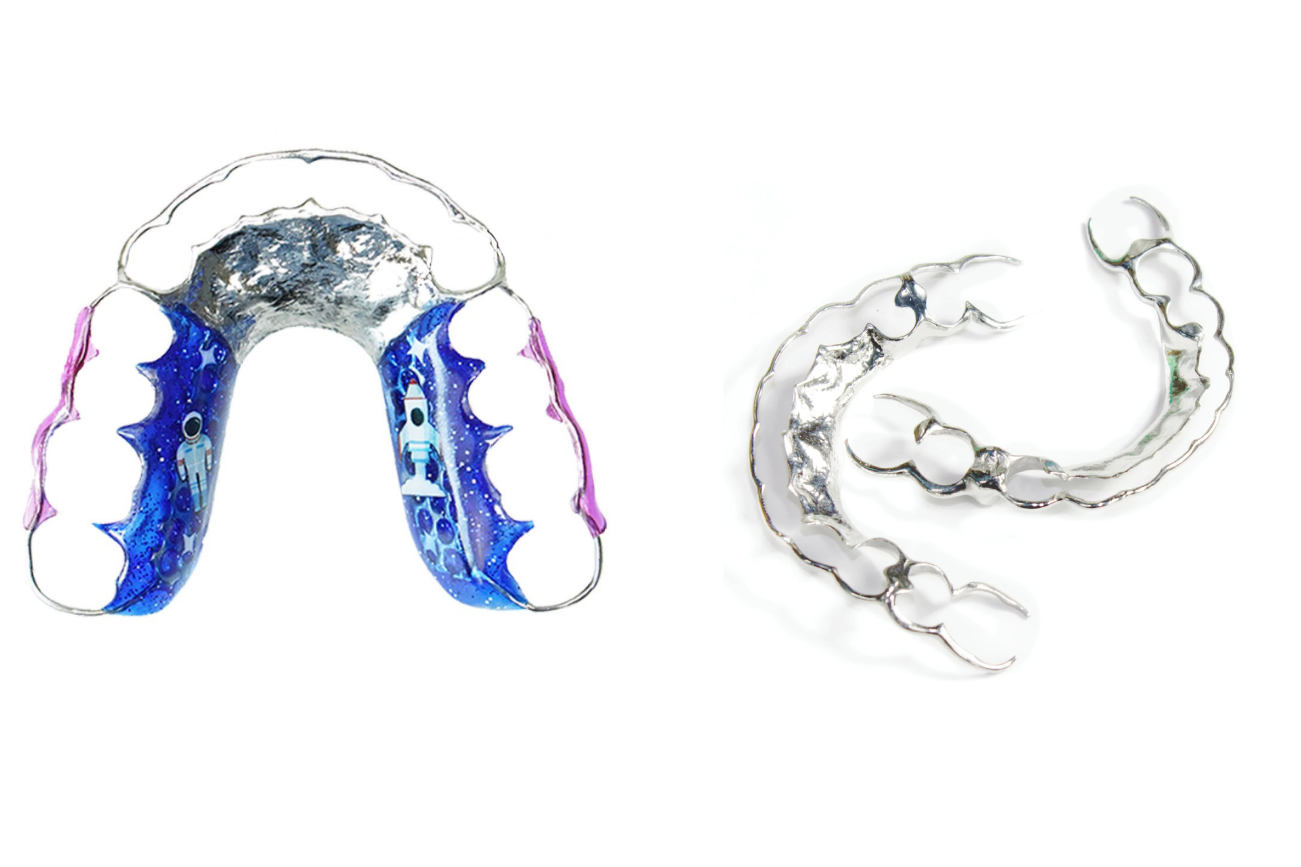 รีเทนเนอร์แบบโลหะ