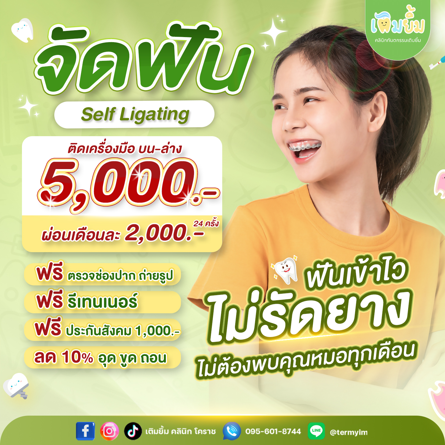 จัดฟันแบบไม่รัดยาง