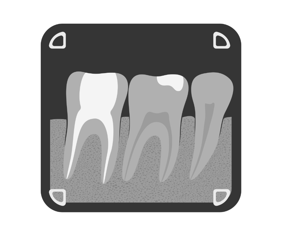 รูปจัดฟัน