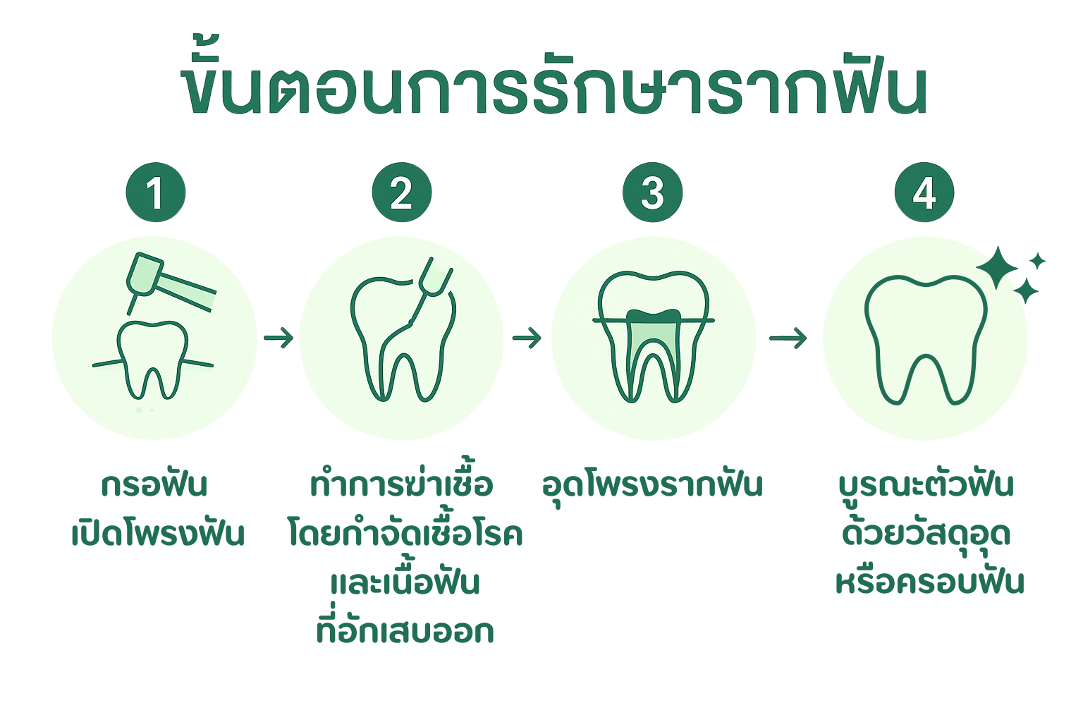 การรักษารากฟัน
