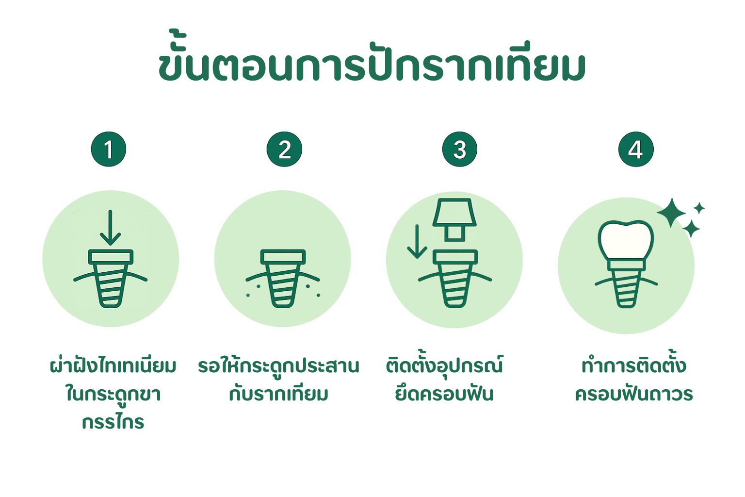 การรักษารากฟัน