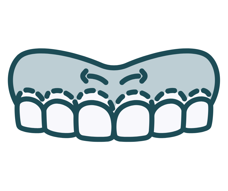 รูปจัดฟัน