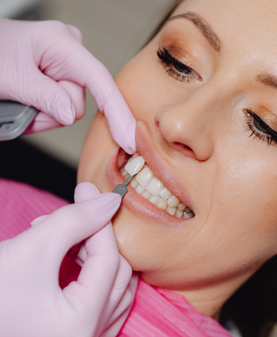 ภาพประกอบวีเนียร์